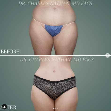 Body Procedure by Dr. Nathan