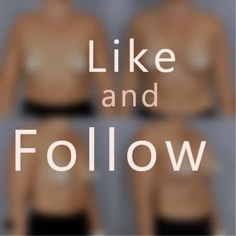 Breast Augmentation Procedure by Dr. Prada - Like and Follow to view