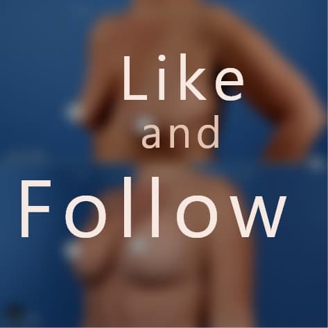Breast Augmentation Procedure by Dr. Sarhaddi - Like and Follow to view