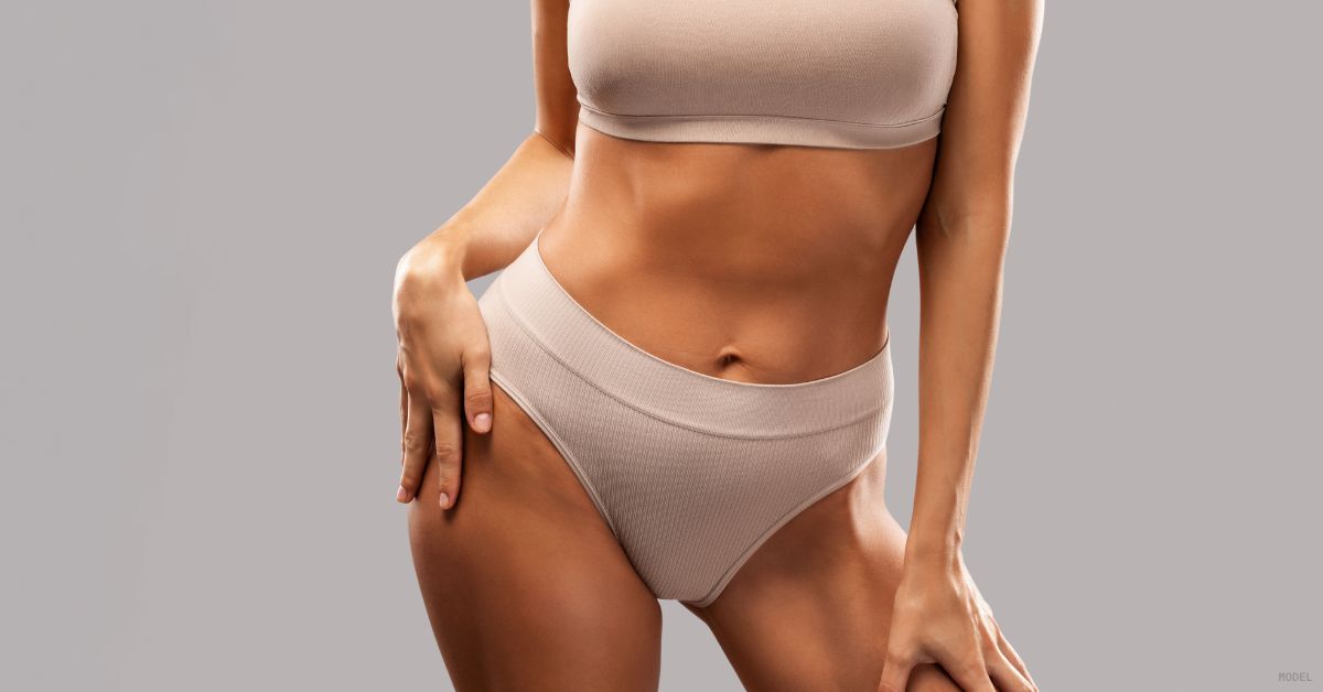 Woman showing off her tummy tuck results (model